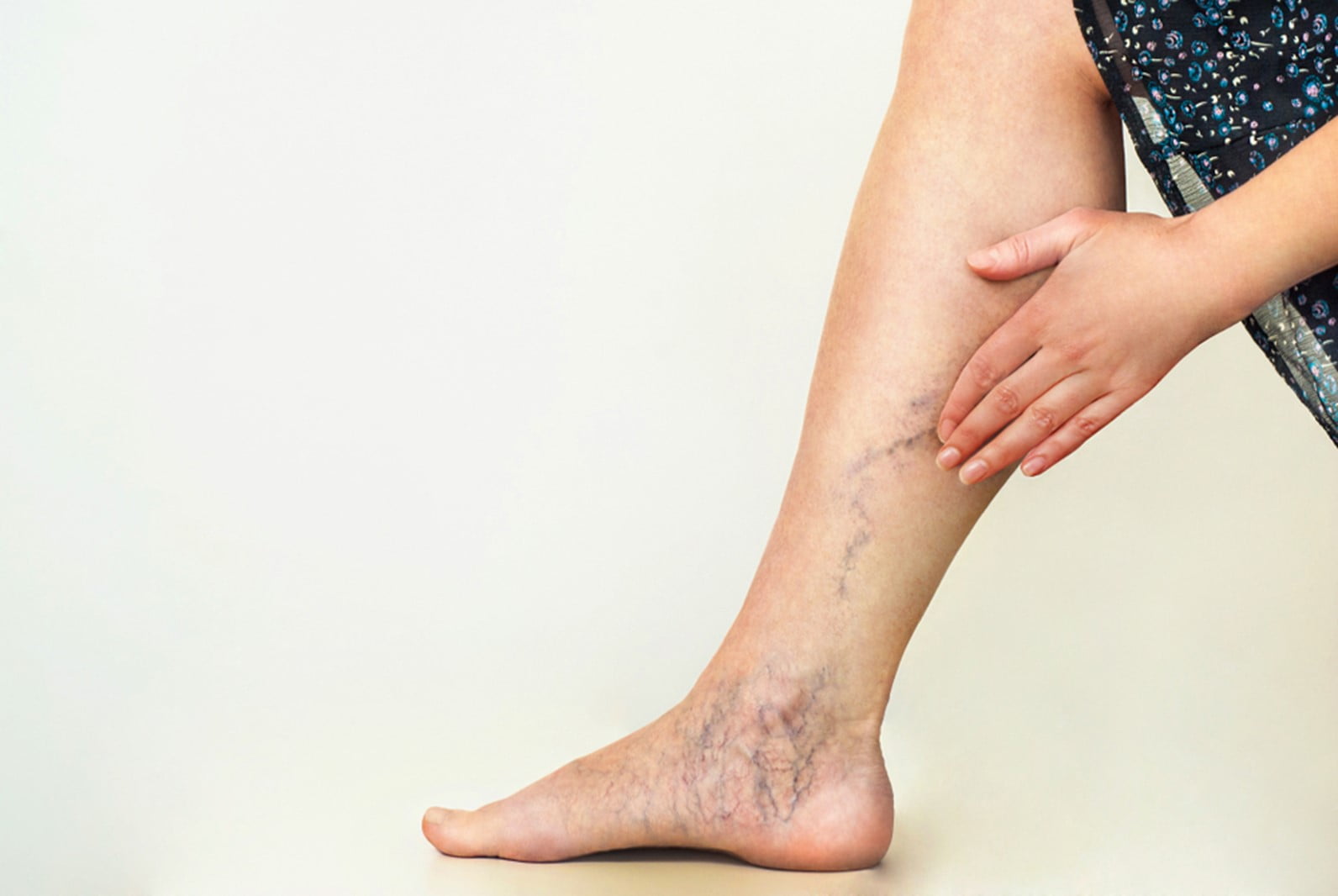 modalitai de tratare varicoza varicoza la stadiul incipient picioare din piele uscata varicoza